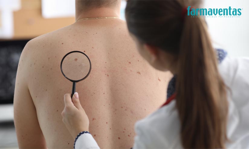 La formación en Dermato-Oncología, fundamental para una eficaz prevención, diagnóstico y tratamiento del cáncer de piel